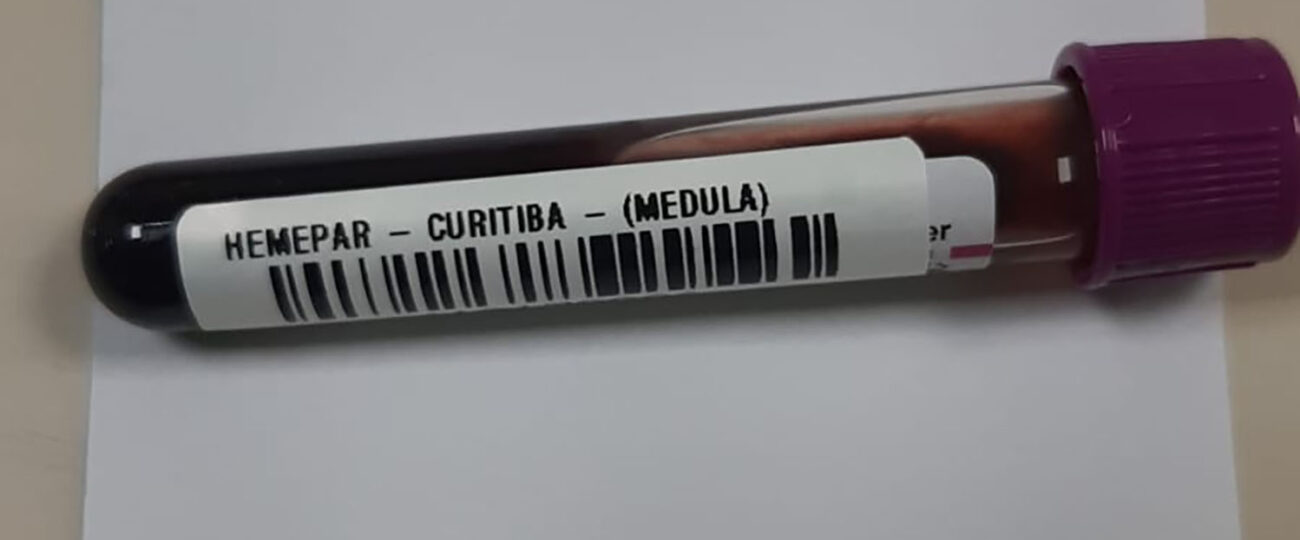 Fevereiro Laranja: mês da conscientização sobre leucemia reforça papel do diagnóstico